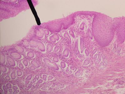 Histology Of Esophagus. Esophagus Histology