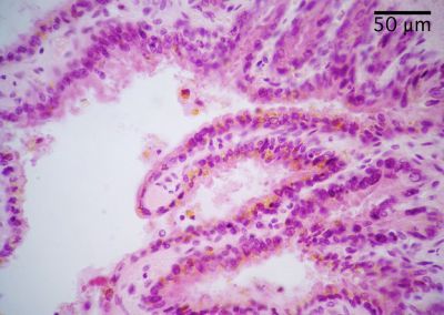 Seminal Vesicle Histology