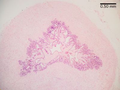 Seminal vesicles - histology slide