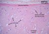 cartilage40X_lbl.jpg
