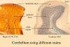 Filename=cerebellumcomposite.jpg
Filesize=166KiB
Dimensions=1024x692
Date added=Jun 14, 2009 cerebellumcomposite.jpg