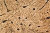 Filename=drybone10X.jpg
Filesize=168KiB
Dimensions=1024x692
Date added=Jan 23, 2009 drybone10X.jpg