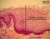 epithelium40X_lbl.jpg