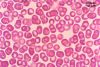 erythrocytes.jpg