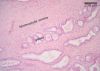 Filename=prostate10X_lbl.jpg
Filesize=340KiB
Dimensions=1024x731
Date added=Jun 12, 2009 prostate10X_lbl.jpg
