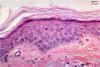 Filename=scalp40X.jpg
Filesize=162KiB
Dimensions=1024x694
Date added=Mar 07, 2009 scalp40X.jpg