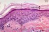 Filename=scalp40X_lbl.jpg
Filesize=166KiB
Dimensions=1024x694
Date added=Mar 07, 2009 scalp40X_lbl.jpg