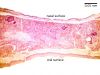 softpalate4X_lbl.jpg