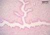 Filename=spongiosum10X.jpg
Filesize=340KiB
Dimensions=1024x732
Date added=Jun 12, 2009 spongiosum10X.jpg