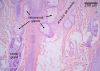 Filename=sweatgland10X_lbl.jpg
Filesize=307KiB
Dimensions=1024x732
Date added=Apr 29, 2009 sweatgland10X_lbl.jpg