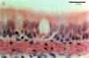 Filename=trachea.jpg
Filesize=138KiB
Dimensions=1024x684
Date added=Jan 28, 2009 trachea.jpg