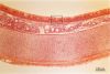 Filename=trachea_lp.jpg
Filesize=166KiB
Dimensions=1024x695
Date added=Jan 28, 2009 trachea_lp.jpg