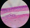 Filename=512px-Human_pseudostratified_ciliated_columnar_epithelium_13.png
Filesize=377KiB
Dimensions=512x474
Date added=Oct 28, 2025 512px-Human_pseudostratified_ciliated_columnar_epithelium_13.png