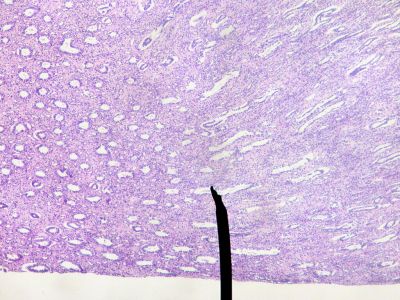 Kidney - histology slide
This is a histology slide of the kidney.

Image by Jpogi at English Wikipedia, via Wikimedia Commons. Public domain.

No changes were made to the original image downloaded (note: this version was downloaded at reduced resolution from Wikimedia Commons).

