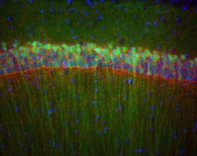 Hippocampus, mouse – histology slide
The CA1 region of the hippocampus from an Nr4a1-eGFP (green) transgenic mouse stained for the CB1 cannabinoid receptor (red) and DAPI to show nuclei (blue). Epifluorescence. 

Creator: Margaret I. Davis 

Photo Source: National Institutes of Health (NIH), via Wikimedia Commons

Usage: No changes were made from the download from Wikimedia Commons.  

File URL: https://commons.wikimedia.org/wiki/File:CA1_hippocampus.jpg

Keywords: rodent