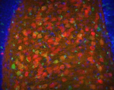Dentate gyrus of hippocampal formation, mouse – histology slide
Cells in the hilus of the dentate gyrus of the hippocampal formation from an Nr4a1-eGFP (green) transgenic mouse stained for calretinin (red) and DAPI (blue) to show nuclei. 

Creator: Margaret I. Davis 

Photo Source: National Institutes of Health (NIH), via Wikimedia Commons

Usage: No changes were made from the download from Wikimedia Commons.  

File URL: 
https://commons.wikimedia.org/wiki/File%3ADentate_gyrus.jpg?utm_source=chatgpt.com

Keywords: rodent
