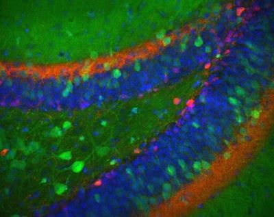 Dentate gyrus of hippocampal formation, mouse – histology slide
The hilus of the dentate gyrus from an Nr4a1-eGFP (green) transgenic mouse stained for calretinin (red) and DAPI (blue) to show nuclei. 

Creator: Margaret I. Davis 

Photo Source: National Institutes of Health (NIH), via Wikimedia Commons

Usage: No changes were made from the download from Wikimedia Commons.  

File URL:
https://commons.wikimedia.org/wiki/File:Dentate_gyrus_II.jpg


Keywords: rodent