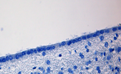 Ependyma - histology slide
Image by Martin Hasselblatt MD, via Wikimedia Commons. 

Original file source: [url=https://commons.wikimedia.org/wiki/File:Ependyma.png] https://commons.wikimedia.org/wiki/File:Ependyma.png[/url]

Title: "Ependyma.png"

No changes were made to the original image downloaded.  

This file is licensed under the Creative Commons Attribution-Share Alike 3.0 Unported license. [url=https://creativecommons.org/licenses/by-sa/3.0/deed.en]https://creativecommons.org/licenses/by-sa/3.0/deed.en[/url]

Keywords: Ependyma