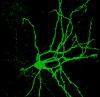 Filename=Confocal_image_of_spiny_neuron_-_1.jpg
Filesize=178KiB
Dimensions=527x512
Date added=Oct 03, 2025 Confocal_image_of_spiny_neuron_-_1.jpg