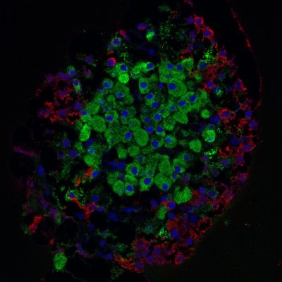Islet of Langerhans - laser scanning confocal microscope image 
Islet of Langerhans isolated from rat pancreas. Laser scanning confocal microscope image. 63x, oil imm. objective. Colors explanation:

•	Nuclei stained blue with DAPI,
•	Insulin (beta-cells) stained green with anti-insuline dye conjugated antibodies,
•	Glucagon (alpha-cells) stained red with anti-glucagon dye conjugated antibodies.

(Description text from the Wikimedia Commons file page.)

Image by [url=https://pl.wikipedia.org/wiki/Wikipedysta:Masur]Masur[/url], via Wikimedia Commons. 

Original file source: [url=https://commons.wikimedia.org/wiki/File:Pancreaticislet.jpg]https://commons.wikimedia.org/wiki/File:Pancreaticislet.jpg [/url]

Title: "Pancreaticislet.jpg"

No changes were made to the original image downloaded.  

This file is licensed under the Creative Commons Attribution-Share Alike 3.0 Unported License [url=https://creativecommons.org/licenses/by-sa/3.0/deed.en]https://creativecommons.org/licenses/by-sa/3.0/deed.en[/url]

Keywords: pancreas