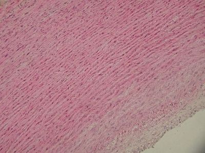 Aorta - histology slide
Image by Department of Histology, Jagiellonian University Medical College ([url=http://histologia.cm-uj.krakow.pl/index.html]1[/url]; [url=https://web.archive.org/web/20060216212659/http://www.histologia.cm-uj.krakow.pl/index.html]archive copy[/url] at the Wayback Machine), via Wikimedia Commons.

Original file source: [url=https://commons.wikimedia.org/wiki/File:Aorta_histo.jpg]https://commons.wikimedia.org/wiki/File:Aorta_histo.jpg[/url]

Title: "Aorta_histo.jpg"

No changes were made to the original image downloaded. 

Permission is granted to copy, distribute and/or modify this document under the terms of the GNU Free Documentation License, Version 1.2 or any later version published by the Free Software Foundation; with no Invariant Sections, no Front-Cover Texts, and no Back-Cover Texts. A copy of the license is included in the section entitled GNU Free Documentation License. [url=https://commons.wikimedia.org/wiki/Commons:GNU_Free_Documentation_License,_version_1.2]https://commons.wikimedia.org/wiki/Commons:GNU_Free_Documentation_License,_version_1.2[/url]

This file is licensed under the Creative Commons Attribution-Share Alike 3.0 Unported License [url=https://creativecommons.org/licenses/by-sa/3.0/deed.en/]https://creativecommons.org/licenses/by-sa/3.0/deed.en/[/url]

