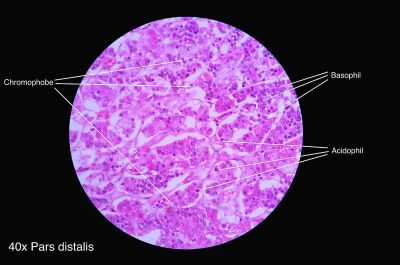 Pituitary gland, pars distalis (labels) – histology slide
This is a histology slide of the pars distalis of the pituitary gland.

Image by Athikhun.suw, via Wikimedia Commons. 

Original file source: [url=https://commons.wikimedia.org/wiki/File:Pars_distalis_2014.jpg]https://commons.wikimedia.org/wiki/File:Pars_distalis_2014.jpg[/url]

Title: "Pars distalis 2014.jpg"

No changes were made to the original image downloaded.  

This file is licensed under the Creative Commons Attribution-Share Alike 4.0 International license. [url=https://creativecommons.org/licenses/by-sa/4.0/deed.en/]https://creativecommons.org/licenses/by-sa/4.0/deed.en/[/url]


