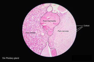 Pituitary gland (labels) - histology slide
This is a histology slide of the pituitary gland.

Image by Athikhun.suw, via Wikimedia Commons. 

Original file source: [url=https://commons.wikimedia.org/wiki/File:Pituitary_gland_histology_2014.jpg]https://commons.wikimedia.org/wiki/File:Pituitary_gland_histology_2014.jpg[/url]

Title: "Pituitary_gland_histology_2014.jpg"

No changes were made to the original image downloaded.  

This file is licensed under the Creative Commons Attribution-Share Alike 4.0 International license. [url=https://creativecommons.org/licenses/by-sa/4.0/deed.en/]https://creativecommons.org/licenses/by-sa/4.0/deed.en/[/url]

