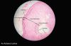 Adrenal_gland_histology_2014.jpg