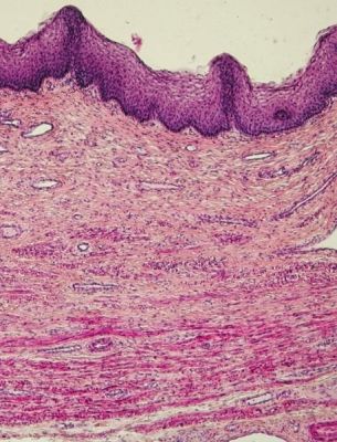 Vaginal tissue - histology slide
Image by Department of Histology, Jagiellonian University Medical College ([url=http://histologia.cm-uj.krakow.pl/index.html]1[/url]; [url=https://web.archive.org/web/20060216212659/http://www.histologia.cm-uj.krakow.pl/index.html]archive copy[/url] at the Wayback Machine), via Wikimedia Commons.

Original file source: [url=https://commons.wikimedia.org/wiki/File:VaginaHisto.jpg]https://commons.wikimedia.org/wiki/File:VaginaHisto.jpg[/url]
Title: "VaginaHisto.jpg"

No changes were made to the original image downloaded. 

Permission is granted to copy, distribute and/or modify this document under the terms of the GNU Free Documentation License, Version 1.2 or any later version published by the Free Software Foundation; with no Invariant Sections, no Front-Cover Texts, and no Back-Cover Texts. A copy of the license is included in the section entitled GNU Free Documentation License. [url=https://commons.wikimedia.org/wiki/Commons:GNU_Free_Documentation_License,_version_1.2]https://commons.wikimedia.org/wiki/Commons:GNU_Free_Documentation_License,_version_1.2[/url]

This file is licensed under the Creative Commons Attribution-Share Alike 3.0 Unported License [url=https://creativecommons.org/licenses/by-sa/3.0/deed.en/]https://creativecommons.org/licenses/by-sa/3.0/deed.en/[/url]


