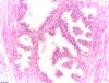 Filename=Prostate_normal_1.jpg
Filesize=111KiB
Dimensions=1260x960
Date added=Oct 11, 2025 Prostate_normal_1.jpg