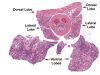 Filename=prostate1.JPG
Filesize=184KiB
Dimensions=553x418
Date added=Sep 28, 2025 prostate1.JPG