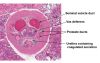 Filename=prostate2.JPG
Filesize=233KiB
Dimensions=692x442
Date added=Sep 28, 2025 prostate2.JPG