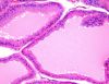 Filename=prostate3.JPG
Filesize=214KiB
Dimensions=520x402
Date added=Sep 28, 2025 prostate3.JPG