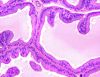 Filename=prostate5.JPG
Filesize=261KiB
Dimensions=516x398
Date added=Sep 28, 2025 prostate5.JPG