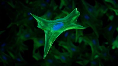 Fibroblast - histology slide
Courtesy of the [url=https://www.genome.gov/]National Human Genome Research Institute (genome.gov)[/url].
Keywords: connective