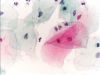 Filename=Pap_test_normal.jpg
Filesize=56KiB
Dimensions=848x640
Date added=Oct 11, 2025 Pap_test_normal.jpg