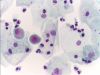Filename=Urine_normal_cytology.jpg
Filesize=55KiB
Dimensions=848x640
Date added=Oct 12, 2025 Urine_normal_cytology.jpg