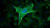 fibroblast.jpg