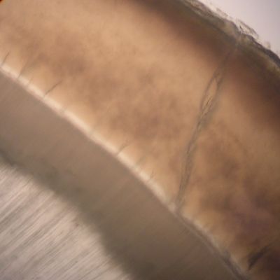 Tooth – histology slide
Histologic cross-section of a tooth showing the enamel and dentin, with enamel lamellae and enamel tufts visible. (Description text from the Wikimedia Commons file page.)

Image by [url=https://commons.wikimedia.org/wiki/User:Dozenist]Dozenist[/url], via Wikimedia Commons. 

Original file source: [url=https://commons.wikimedia.org/wiki/File:EnamelLayer04-11-07.jpg]https://commons.wikimedia.org/wiki/File:EnamelLayer04-11-07.jpg[/url]

Title: "EnamelLayer04-11-07.jpg"

No changes were made to the original image downloaded.  

Permission is granted to copy, distribute and/or modify this document under the terms of the GNU Free Documentation License, Version 1.2 or any later version published by the Free Software Foundation; with no Invariant Sections, no Front-Cover Texts, and no Back-Cover Texts. A copy of the license is included in the section entitled GNU Free Documentation License. [url=https://commons.wikimedia.org/wiki/Commons:GNU_Free_Documentation_License,_version_1.2]https://commons.wikimedia.org/wiki/Commons:GNU_Free_Documentation_License,_version_1.2[/url]

This file is licensed under the Creative Commons Attribution-Share Alike 3.0 Unported license. [url=https://creativecommons.org/licenses/by-sa/3.0/deed.en]https://creativecommons.org/licenses/by-sa/3.0/deed.en[/url]

This file is licensed under the Creative Commons Attribution-Share Alike [url=https://creativecommons.org/licenses/by-sa/2.5/deed.en]2.5 Generic[/url], [url=https://creativecommons.org/licenses/by-sa/2.0/deed.en]2.0 Generic[/url] and [url=https://creativecommons.org/licenses/by-sa/1.0/deed.en]1.0 Generic[/url] license.
