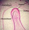 Filename=Enamelmineralization11-17-05.jpg
Filesize=391KiB
Dimensions=904x936
Date added=Oct 17, 2025 Enamelmineralization11-17-05.jpg