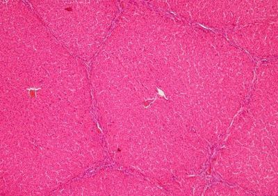 Animal liver - histology slide
Image by Department of Histology, Jagiellonian University Medical College ([url=http://histologia.cm-uj.krakow.pl/index.html]1[/url]; [url=https://web.archive.org/web/20060216212659/http://www.histologia.cm-uj.krakow.pl/index.html]archive copy[/url] at the Wayback Machine), via Wikimedia Commons.

Original file source: [url=https://commons.wikimedia.org/wiki/File:Animal_liver.jpg]https://commons.wikimedia.org/wiki/File:Animal_liver.jpg[/url]

Title: "Animal liver.jpg"

No changes were made to the original image downloaded. 

Permission is granted to copy, distribute and/or modify this document under the terms of the GNU Free Documentation License, Version 1.2 or any later version published by the Free Software Foundation; with no Invariant Sections, no Front-Cover Texts, and no Back-Cover Texts. A copy of the license is included in the section entitled GNU Free Documentation License. [url=https://commons.wikimedia.org/wiki/Commons:GNU_Free_Documentation_License,_version_1.2]https://commons.wikimedia.org/wiki/Commons:GNU_Free_Documentation_License,_version_1.2[/url]

This file is licensed under the Creative Commons Attribution-Share Alike 3.0 Unported License [url=https://creativecommons.org/licenses/by-sa/3.0/deed.en/]https://creativecommons.org/licenses/by-sa/3.0/deed.en/[/url]
