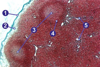 Lymph node (labels) – histology slide
Lymph node, showing (1) capsule, (2) subcapsular sinus, (3) germinal centers, (4) lymphoid nodule, (5) trabeculae. (Description text from the Wikimedia Commons file page.)

Image by [url=https://de.wikipedia.org/wiki/Benutzer:Gleiberg]Gleiberg[/url], via Wikimedia Commons.

Original file source: [url=https://commons.wikimedia.org/wiki/File:Lymphknoten_(Schwein).jpg]https://commons.wikimedia.org/wiki/File:Lymphknoten_(Schwein).jpg[/url]

No changes were made to the original image downloaded (downloaded at reduced resolution from Wikimedia Commons).

This file is licensed under the Creative Commons Attribution-Share Alike 2.0 Germany license. [url=https://creativecommons.org/licenses/by-sa/2.0/de/deed.en] https://creativecommons.org/licenses/by-sa/2.0/de/deed.en[/url]



