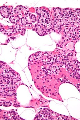 Parathyroid gland - histology slide
This image shows a histology slide of the parathyroid gland.

Image by [url=https://commons.wikimedia.org/wiki/User:Nephron]Nephron[/url], via Wikimedia Commons.

Original file source: [url=https://commons.wikimedia.org/wiki/File:Parathyroid_gland_high_mag.jpg][/url]

Title: "Parathyroid_gland_high_mag.jpg"

No changes were made to the original image downloaded (note: this version was downloaded at reduced resolution from Wikimedia Commons).

This file is licensed under the Creative Commons Attribution-Share Alike 3.0 Unported License [url=https://creativecommons.org/licenses/by-sa/3.0/deed.en]https://creativecommons.org/licenses/by-sa/3.0/deed.en[/url].

Copyright © 2009 Michael Bonert, MD, FRCPC ([url=https://commons.wikimedia.org/wiki/User:Nephron]https://commons.wikimedia.org/wiki/User:Nephron[/url] / [url=https://experts.mcmaster.ca/display/bonertm]https://experts.mcmaster.ca/display/bonertm[/url])

You are free to share and adapt this image as per the CC BY-SA 3.0 ([url=https://creativecommons.org/licenses/by-sa/3.0/legalcode]https://creativecommons.org/licenses/by-sa/3.0/legalcode[/url])

