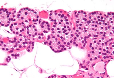 Parathyroid gland - histology slide
This image shows a histology slide of the parathyroid gland.

Image by [url=https://commons.wikimedia.org/wiki/User:Nephron]Nephron[/url], via Wikimedia Commons.

Original file source: [url=https://commons.wikimedia.org/wiki/File:Parathyroid_gland_high_mag_cropped.jpg] https://commons.wikimedia.org/wiki/File:Parathyroid_gland_high_mag_cropped.jpg [/url]

Title: "Parathyroid_gland_high_mag_cropped.jpg"

No changes were made to the original image downloaded (note: this version was downloaded at reduced resolution from Wikimedia Commons).

This file is licensed under the Creative Commons Attribution-Share Alike 3.0 Unported License [url=https://creativecommons.org/licenses/by-sa/3.0/deed.en]https://creativecommons.org/licenses/by-sa/3.0/deed.en[/url].

Copyright © 2009 Michael Bonert, MD, FRCPC ([url=https://commons.wikimedia.org/wiki/User:Nephron]https://commons.wikimedia.org/wiki/User:Nephron[/url] / [url=https://experts.mcmaster.ca/display/bonertm]https://experts.mcmaster.ca/display/bonertm[/url])

You are free to share and adapt this image as per the CC BY-SA 3.0 ([url=https://creativecommons.org/licenses/by-sa/3.0/legalcode]https://creativecommons.org/licenses/by-sa/3.0/legalcode[/url])


