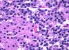 Filename=1024px-Parathyroid_oxyphil_and_chief_cells.jpg
Filesize=186KiB
Dimensions=1024x756
Date added=Sep 30, 2025 1024px-Parathyroid_oxyphil_and_chief_cells.jpg