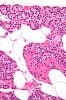 Parathyroid_gland_high_mag.jpg