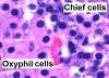 Filename=Parathyroid_oxyphil_and_chief_cells_-_annotated.jpg
Filesize=160KiB
Dimensions=911x665
Date added=Sep 30, 2025 Parathyroid_oxyphil_and_chief_cells_-_annotated.jpg