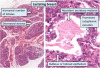512px-Histology_of_lactating_breast2C_annotated.png