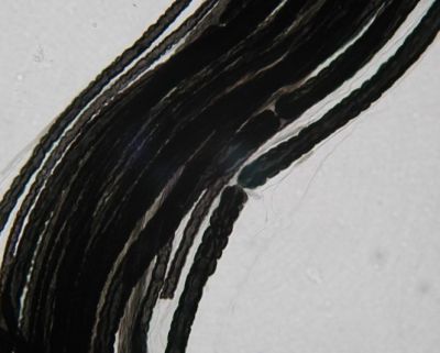 Myelinated nerve fibers - histology slide
Image by Department of Histology, Jagiellonian University Medical College ([url=http://histologia.cm-uj.krakow.pl/index.html]1[/url]; [url=https://web.archive.org/web/20060216212659/http://www.histologia.cm-uj.krakow.pl/index.html]archive copy[/url] at the Wayback Machine), via Wikimedia Commons.

Original file source: [url=https://commons.wikimedia.org/wiki/File:Myelinated_nerve_fibers,_Ranvier_nodes.jpg]https://commons.wikimedia.org/wiki/File:Myelinated_nerve_fibers,_Ranvier_nodes.jpg[/url]

Title: "Myelinated nerve fibers, Ranvier nodes.jpg"

No changes were made to the original image downloaded. 

Permission is granted to copy, distribute and/or modify this document under the terms of the GNU Free Documentation License, Version 1.2 or any later version published by the Free Software Foundation; with no Invariant Sections, no Front-Cover Texts, and no Back-Cover Texts. A copy of the license is included in the section entitled GNU Free Documentation License. [url=https://commons.wikimedia.org/wiki/Commons:GNU_Free_Documentation_License,_version_1.2]https://commons.wikimedia.org/wiki/Commons:GNU_Free_Documentation_License,_version_1.2[/url]

This file is licensed under the Creative Commons Attribution-Share Alike 3.0 Unported License [url=https://creativecommons.org/licenses/by-sa/3.0/deed.en/]https://creativecommons.org/licenses/by-sa/3.0/deed.en/[/url]
