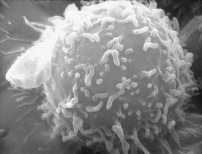 Lymphocyte - EM
Electron microscopic image of a single human lymphocyte. (Description from the National Cancer Institute Visuals Online page.)

Title: Human Lymphocyte

Image and description: [url=https://visualsonline.cancer.gov/details.cfm?imageid=1944] https://visualsonline.cancer.gov/details.cfm?imageid=1944 [/url]

Originator: NCI

Source: The Web site of the National Cancer Institute ([url=https://www.cancer.gov]https://www.cancer.gov[/url])

Dr. Triche. National Cancer Institute, Sep 20 1976

Creator: Unknown Photographer



